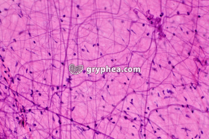 Réseau fibres nerveuses ME x100 - gryphea.com